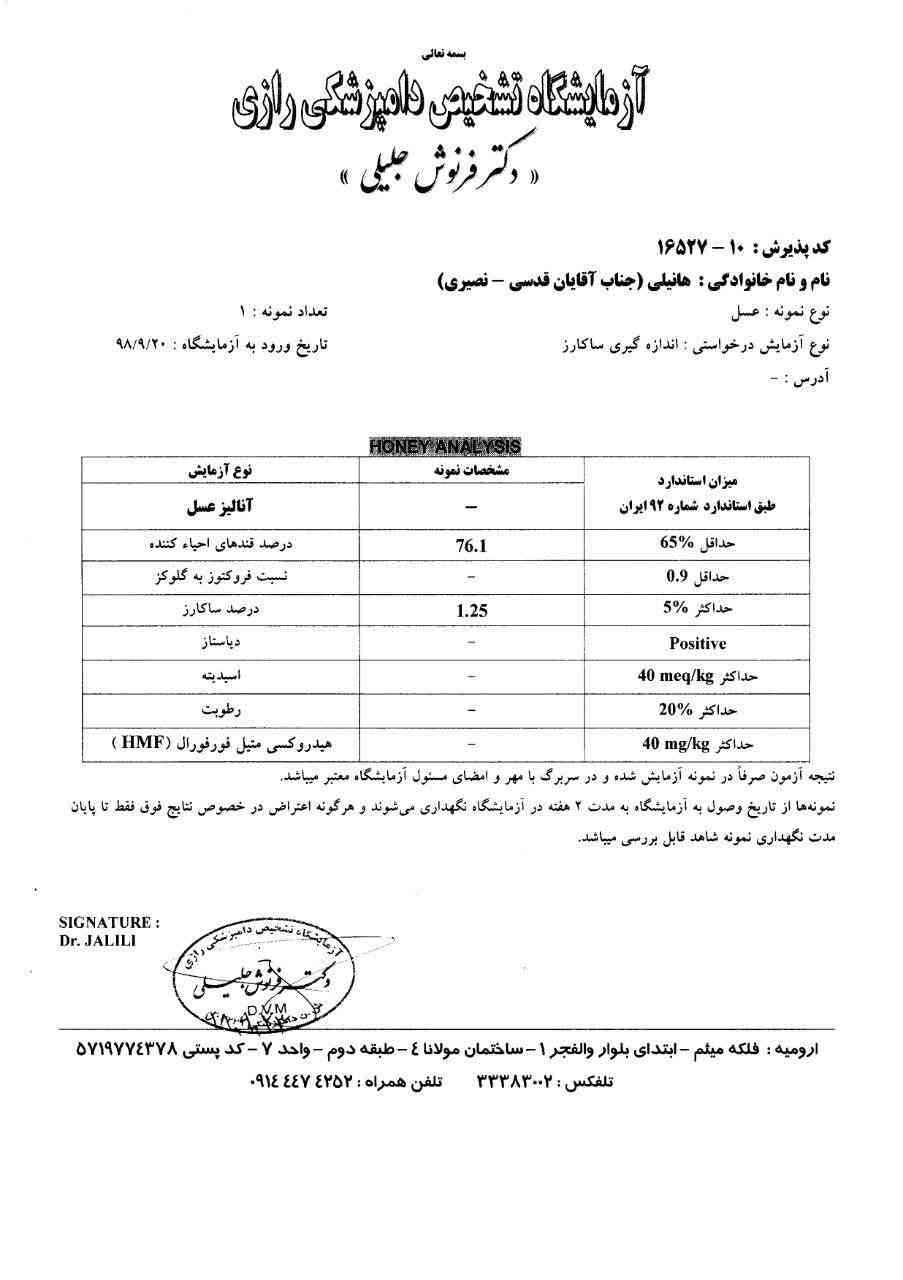 نتیجه آزمایش عطاله قدسی